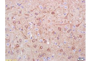 Formalin-fixed and paraffin embedded rat brain labeled with Rabbit Anti DDC/DOPA Decarboxylase Polyclonal Antibody, Unconjugated (ABIN725945) at 1:200 followed by conjugation to the secondary antibody and DAB staining (DDC antibody  (AA 201-300))