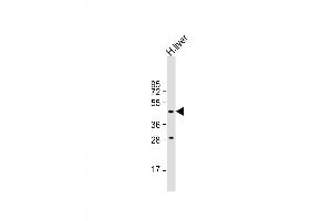 Western Blot at 1:500 dilution + human liver lysate Lysates/proteins at 20 ug per lane. (MMAA antibody  (N-Term))