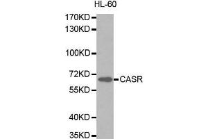 Western blot analysis of extracts of HL-60 cells lines, using CASR antibody. (CASR antibody  (AA 874-1088))