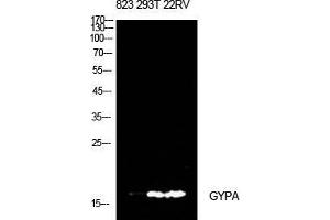 Western Blot (WB) analysis of 823, 293T, 22RV cells using CD235a Polyclonal Antibody. (CD235a/GYPA antibody  (Internal Region))