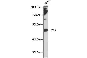 Western blot analysis of extracts of HeLa cells, using ZP3 antibody (ABIN6134464, ABIN6150536, ABIN6150538 and ABIN6217045) at 1:3000 dilution. (Zona Pellucida Glycoprotein 3 antibody  (AA 250-350))