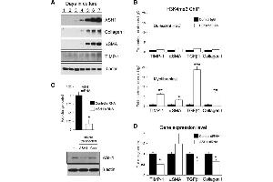 Western Blotting (WB) image for anti-COL1A2/COL1A1 antibody (ABIN5596819)
