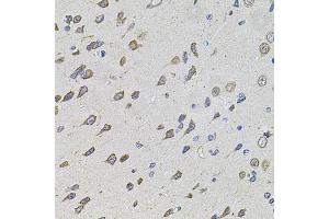 Immunohistochemistry of paraffin-embedded rat brain using FOXO3 antibody (ABIN5974623) at dilution of 1/100 (40x lens). (FOXO3 antibody)