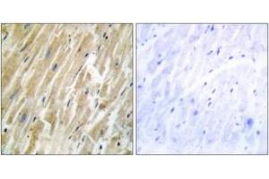 Immunohistochemistry (IHC) image for anti-Calreticulin (CALR) (AA 21-70) antibody (ABIN2889442) (Calreticulin antibody  (AA 21-70))