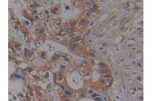 Immunohistochemistry (IHC) image for anti-Nucleoporin 155kDa (NUP155) (AA 1154-1379) antibody (ABIN7444085)
