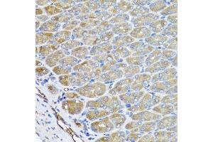 Immunohistochemistry of paraffin-embedded mouse stomach using VPS37A antibody. (VPS37A antibody  (AA 224-397))