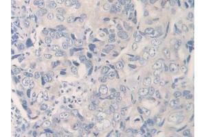 Used in DAB staining on fromalin fixed paraffin- embedded kidney tissue (IL12A antibody  (AA 23-219))