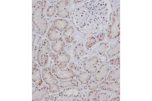 Immunohistochemical analysis of E on paraffin-embedded Human kidney tissue. (BRAF antibody  (AA 379-408))