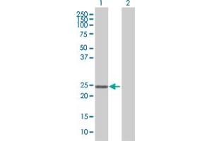 Western Blot analysis of ZNF22 expression in transfected 293T cell line by ZNF22 MaxPab polyclonal antibody. (Zinc Finger Protein 22 antibody  (AA 1-224))