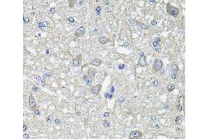 Immunohistochemistry of paraffin-embedded Rat brain using GFPT1 Polyclonal Antibody at dilution of 1:100 (40x lens). (GFPT1 antibody)
