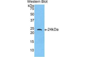 Western Blotting (WB) image for anti-Toll-Like Receptor 5 (TLR5) (AA 46-205) antibody (ABIN3205672) (TLR5 antibody  (AA 46-205))
