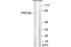 Western blot analysis of extracts from K562 cells, using PRPF39 antibody. (PRPF39 antibody  (Internal Region))