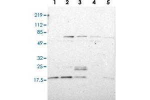 Western blot analysis of Lane 1: RT-4, Lane 2: U-251 MG, Lane 3: A-431, Lane 4: Liver, Lane 5: Tonsil with ATF3 polyclonal antibody  at 1:100-1:250 dilution. (ATF3 antibody)
