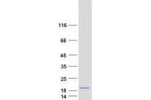 Validation with Western Blot