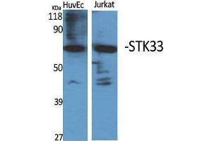 Western Blot (WB) analysis of specific cells using STK33 Polyclonal Antibody. (STK33 antibody  (N-Term))