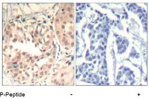 Image no. 2 for anti-Cyclin-Dependent Kinase 6 (CDK6) (pTyr13) antibody (ABIN401596) (CDK6 antibody  (pTyr13))