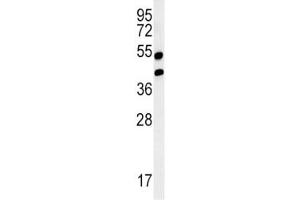 Western blot analysis of AGER / RAGE in mouse lung tissue lysate. (RAGE antibody  (AA 29-59))