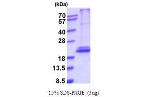 SDS-PAGE (SDS) image for Interleukin 28B (Interferon, lambda 3) (IL28B) (AA 22-196) protein (His tag) (ABIN5778849)