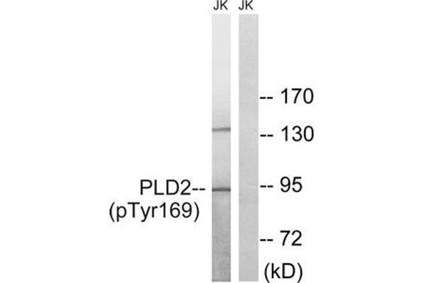 Phospholipase D2 antibody  (pTyr169)