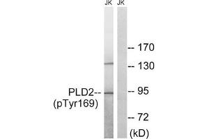 Western blot analysis of extracts from Jurkat cells treated with TNF using PLD2 (Phospho-Tyr169) Antibody. (Phospholipase D2 antibody  (pTyr169))