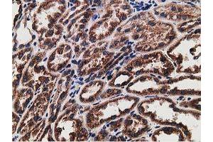 Immunohistochemical staining of paraffin-embedded Human Kidney tissue using anti-LMAN1 mouse monoclonal antibody. (LMAN1 antibody)