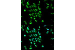 Immunofluorescence analysis of MCF-7 cells using PSMC5 antibody (ABIN5970727). (PSMC5 antibody)