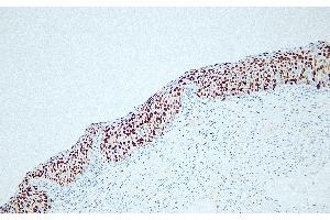 Immunohistochemistry (IHC) image for anti-Antigen Identified By Monoclonal Antibody Ki-67 (MKI67) antibody (ABIN7598906) (Ki-67 antibody)