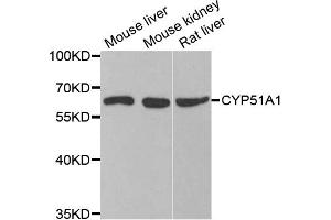 Western blot analysis of extracts of various cell lines, using CYP51A1 antibody. (CYP51A1 antibody)