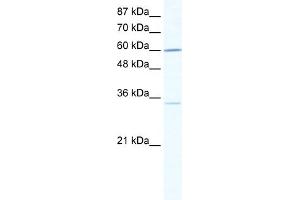 WB Suggested Anti-ZNF668 Antibody Titration:  0. (ZNF668 antibody  (N-Term))