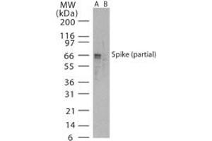 Image no. 1 for anti-SARS-Coronavirus Spike Protein (SARS-CoV S) (AA 288-303) antibody (ABIN199981)