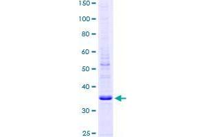 Image no. 1 for Dexamethasone-Induced Transcript (DEXI) (AA 1-95) protein (GST tag) (ABIN1351475) (DEXI Protein (AA 1-95) (GST tag))