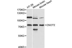Western blot analysis of extracts of various cell lines, using CNOT2 antibody (ABIN6290147) at 1:3000 dilution.