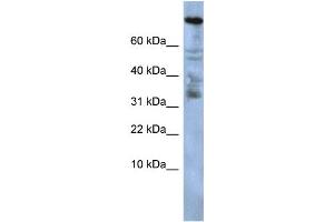 WB Suggested Anti-ZNF251 Antibody Titration:  0. (ZNF251 antibody  (Middle Region))