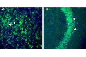 Expression of thromboxane A2 receptor in mouse cortex and hippocampus - Immunohistochemical staining of perfusion-fixed frozen mouse brain sections with Anti-Thromboxane A2 Receptor Antibody (ABIN7043809, ABIN7045124 and ABIN7045125), (1:200), followed by goat anti-rabbit-AlexaFluor-488. (TBXA2R antibody  (3rd Intracellular Loop))