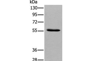 Western blot analysis of Human pancreas tissue using GPC4 Polyclonal Antibody at dilution of 1:500 (GPC4 antibody)