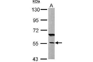 WB Image Sample (50 ug of whole cell lysate) A: Mouse brain 7. (DNAJC7 antibody  (Center))