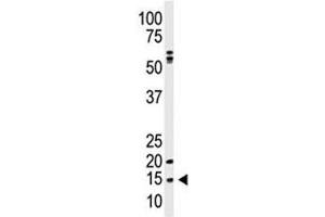 Western blot analysis of SUMO antibody and A375 lysate.