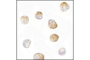 Immunohistochemistry (IHC) image for anti-BCL2-Like 11 (Apoptosis Facilitator) (BCL2L11) (AA 2-198) antibody (ABIN492531) (BIM antibody  (AA 2-198))