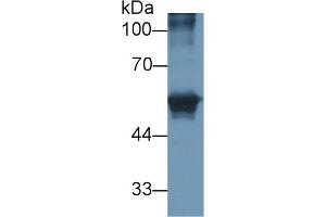 Detection of CEACAM1 in Human HepG2 cell lysate using Polyclonal Antibody to Carcinoembryonic Antigen Related Cell Adhesion Molecule 1 (CEACAM1) (CEACAM1 antibody)