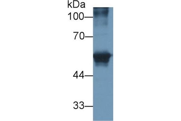 CEACAM1 antibody
