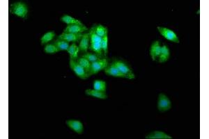 Immunofluorescence staining of HepG2 cells with ABIN7159237 at 1:266, counter-stained with DAPI. (PRAME antibody  (AA 1-509))