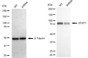 Western blotting analysis using STAT1 antibody (ABIN7800337).