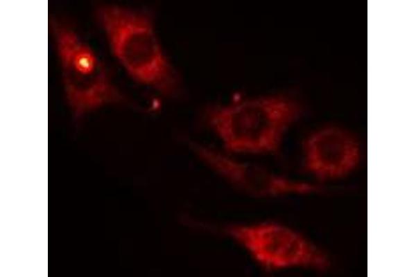 MYBPC1 antibody  (Internal Region)