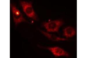 ABIN6275265 staining 293 cells by IF/ICC. (MYBPC1 antibody  (Internal Region))