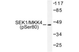 Image no. 1 for anti-Mitogen-Activated Protein Kinase Kinase 4 (MAP2K4) (pSer80) antibody (ABIN318113) (MAP2K4 antibody  (pSer80))