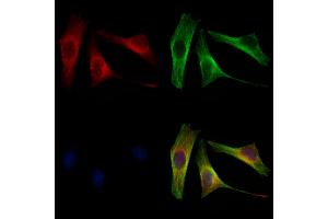 ABIN6264682 and ABIN6272949 staining 3 by IF/ICC. (RDH10 antibody  (Internal Region))