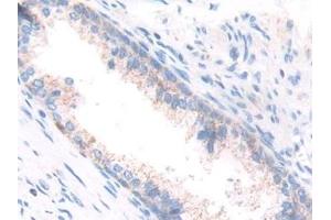 Detection of ECH1 in Human Prostate Tissue using Polyclonal Antibody to Enoyl Coenzyme A Hydratase 1, Peroxisomal (ECH1) (ECH1 antibody  (AA 1-328))