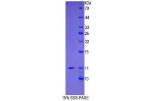 SDS-PAGE (SDS) image for Prostate Stem Cell Antigen (PSCA) (AA 22-123) protein (His tag) (ABIN1080579)