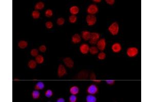 Immunofluorescence analysis of 293T cells using SLC25A17 Polyclonal Antibody at dilution of 1:100 (40x lens). (SLC25A17 antibody)