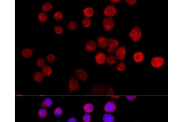 SLC25A17 antibody